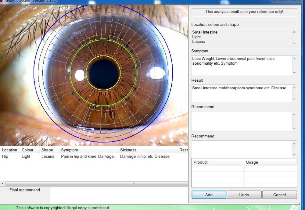 Best Iridology Camera